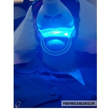 Teeth whitening 