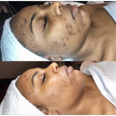 Deep cleansing facials 