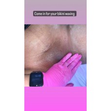 Bikini waxing 