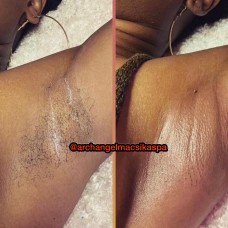 Underarm waxing 